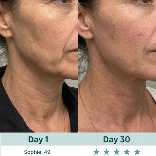7-in-1 LED Facial Sculptor