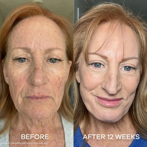 7-in-1 LED Facial Sculptor